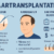 Haartransplantation ab wann sinnvoll