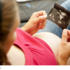 schwangere frau betrachtet ultraschallbild
