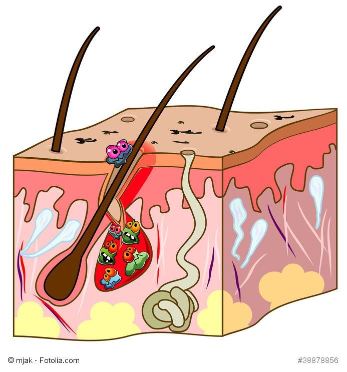 Allergene Stoffe