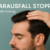 Alopezie stoppen