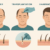 Ablauf der Haartransplantation