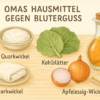 Omas Hausmittel gegen Bluterguss Hausapotheke