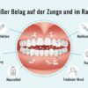 Belag auf Zunge und Rachen
